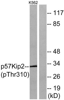 p57 (phospho Thr310) rabbit pAb Antibody