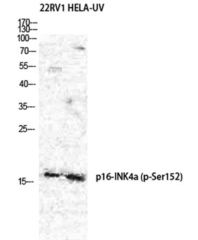 p16-INK4a (Phospho-Ser152) rabbit pAb Antibody