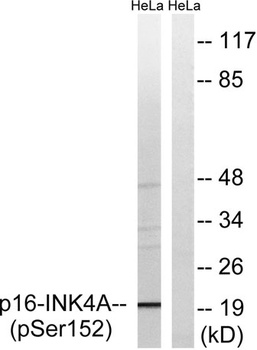p16-INK4a (Phospho-Ser152) rabbit pAb Antibody