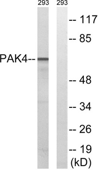 PAK4/5/6 rabbit pAb Antibody