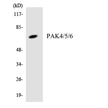 PAK4/5/6 rabbit pAb Antibody