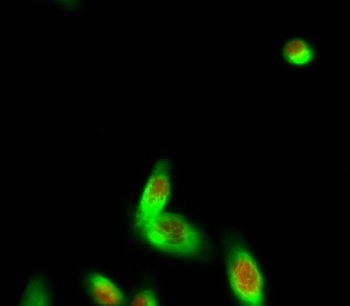 Hec1 rabbit pAb Antibody