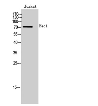 Hec1 rabbit pAb Antibody