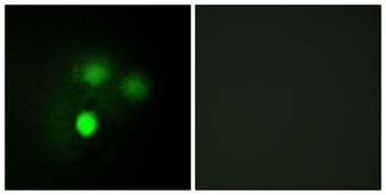 Hec1 rabbit pAb Antibody