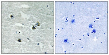 MerTK/Tyro3 (phospho Tyr749/681) rabbit pAb Antibody