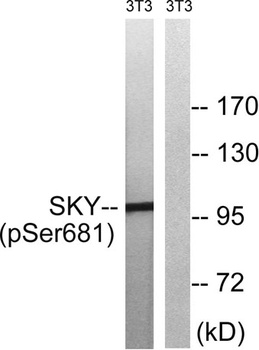 MerTK/Tyro3 (phospho Tyr749/681) rabbit pAb Antibody