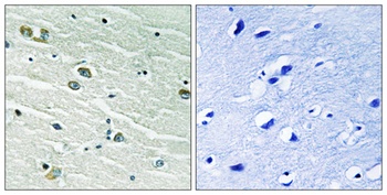 MerTK/Tyro3 rabbit pAb Antibody