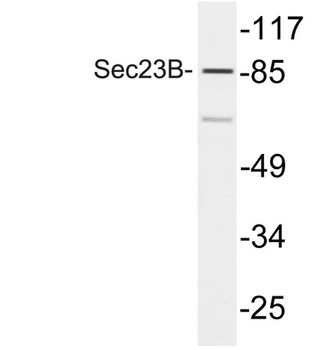 Sec23B rabbit pAb Antibody