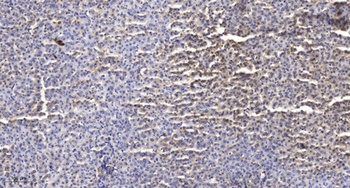 Sec23B rabbit pAb Antibody