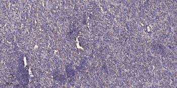 TIP60 (phospho Ser86) rabbit pAb Antibody