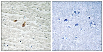 C/EBP ε (phospho Thr74) rabbit pAb Antibody