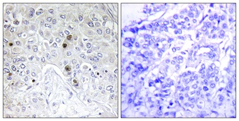 B-ATF rabbit pAb Antibody