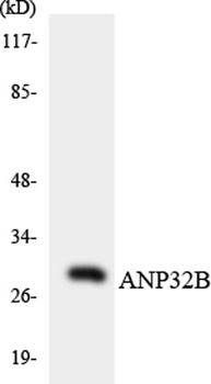 PHAPI2 rabbit pAb Antibody
