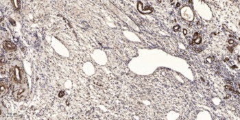 PHAPI2 rabbit pAb Antibody