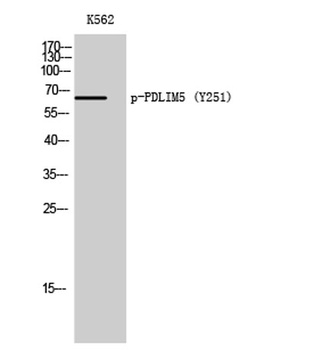 PDLIM5 (phospho Tyr251) rabbit pAb Antibody