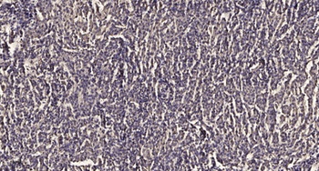 PDLIM5 (phospho Tyr251) rabbit pAb Antibody