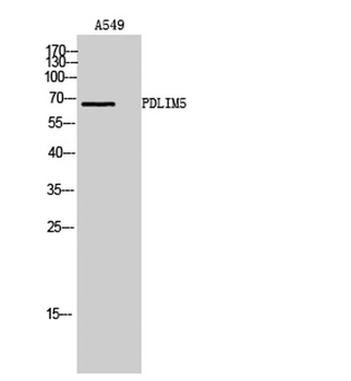 PDLIM5 rabbit pAb Antibody