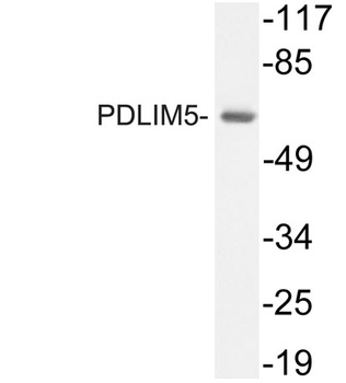 PDLIM5 rabbit pAb Antibody