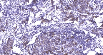 PDLIM5 rabbit pAb Antibody