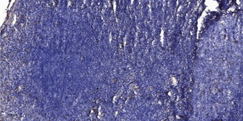 MLC-2 (phospho Thr17/S18) rabbit pAb Antibody