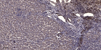 MLC-2 (phospho Thr17/S18) rabbit pAb Antibody