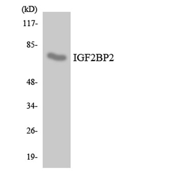 IGF2-BP2 rabbit pAb Antibody