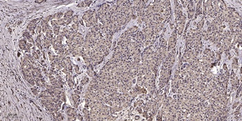NFAT5 (phospho Ser155) rabbit pAb Antibody