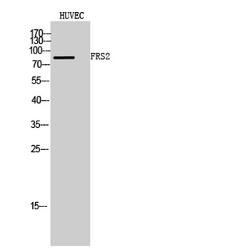 FRS2 rabbit pAb Antibody