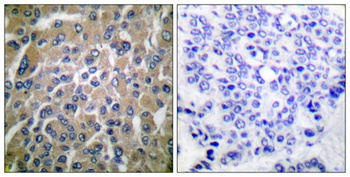 Choriogonadotropin β rabbit pAb Antibody
