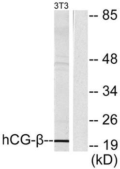 Choriogonadotropin β rabbit pAb Antibody