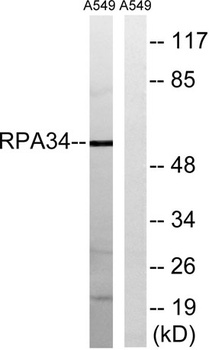 CD3EAP rabbit pAb Antibody