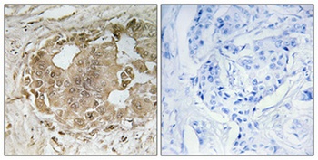 MALT1 rabbit pAb Antibody