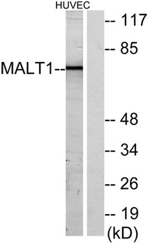 MALT1 rabbit pAb Antibody