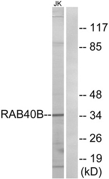 Rab 40B rabbit pAb Antibody