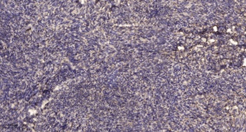 Rab 31 rabbit pAb Antibody