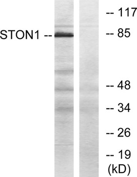Stonin-1 rabbit pAb Antibody
