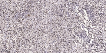 SCG10 (phospho Ser73) rabbit pAb Antibody