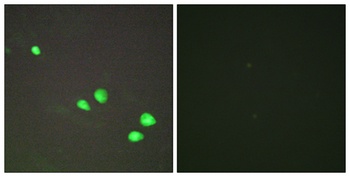 Mi2-β rabbit pAb Antibody