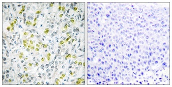 Mi2-β rabbit pAb Antibody