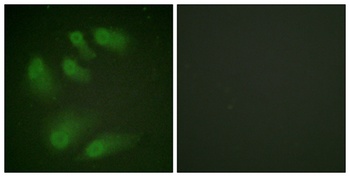 Chk1 (phospho Ser286) rabbit pAb Antibody