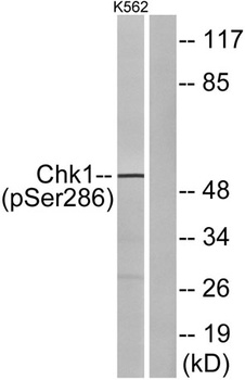 Chk1 (phospho Ser286) rabbit pAb Antibody