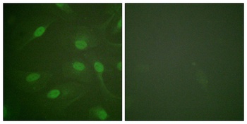 Chk1 (phospho Ser301) rabbit pAb Antibody