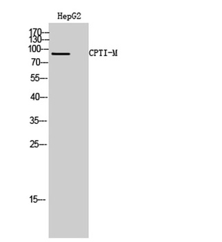 CPTI-M rabbit pAb Antibody