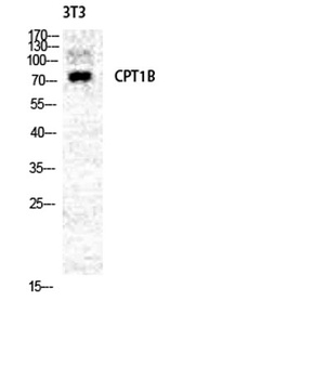 CPTI-M rabbit pAb Antibody