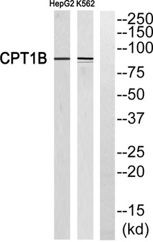 CPTI-M rabbit pAb Antibody