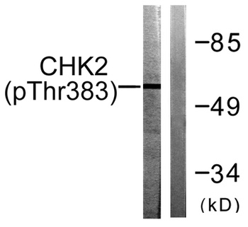 Chk2 (phospho Thr383) rabbit pAb Antibody