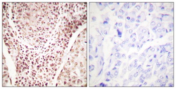 Chk2 (phospho Thr387) rabbit pAb Antibody