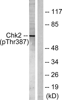 Chk2 (phospho Thr387) rabbit pAb Antibody