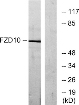 Frizzled-10 rabbit pAb Antibody