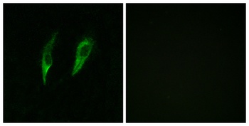 IRAK-M rabbit pAb Antibody